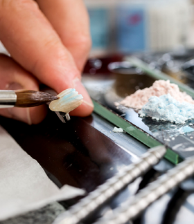 Keramikzahn Team Ralf Martin